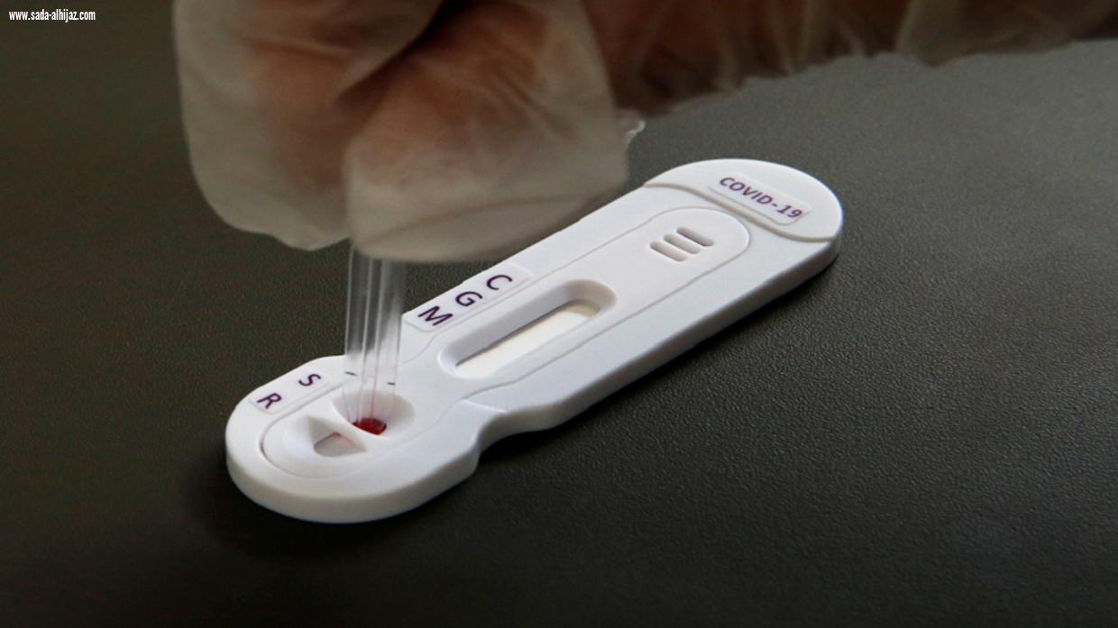 اختبار الأجسام المضادة لفيروس كورونا المغير لقواعد اللعبةيجتاز أولى التجارب بنتائج واعدة!