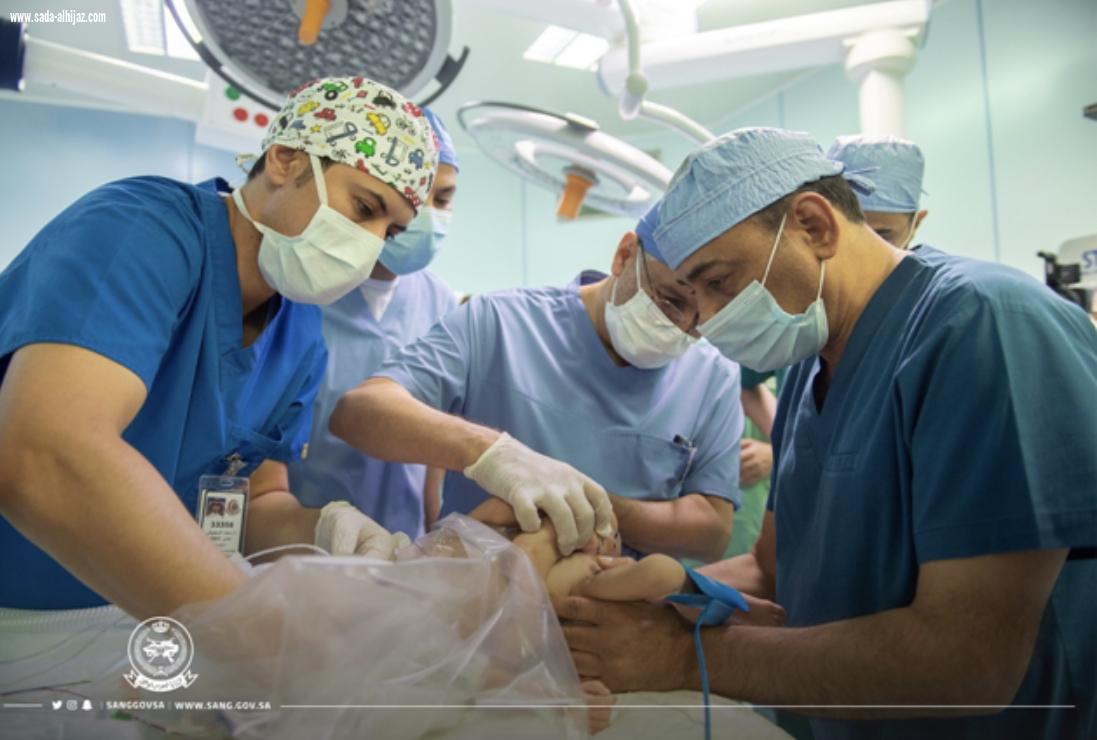 اكتمل العدد 50 عملية جميعها بأيدي الربيعة قصص نجاح فصل التوائم تُحول المملكة إلى أيقونة تفوق طبي استثنائي