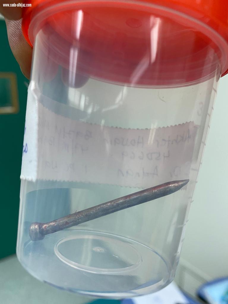 إصابات الشريان الأورطي عادة تؤدي للوفاة التدخل الطبي بتخصصي الطائف ينجح في إنقاذ حياة عامل أصيب بمسمار بالشريان الأورطي