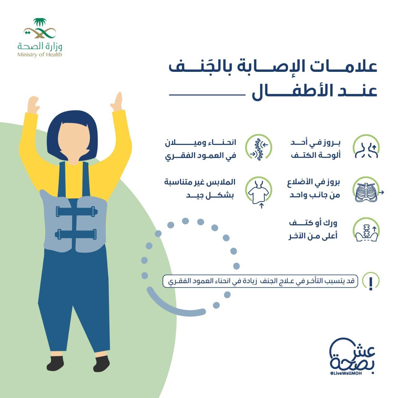صحة جدة تحرص بنشر التوعية لمرض الجنف  بمناسبة اليوم العالمي لمرضى الجنف