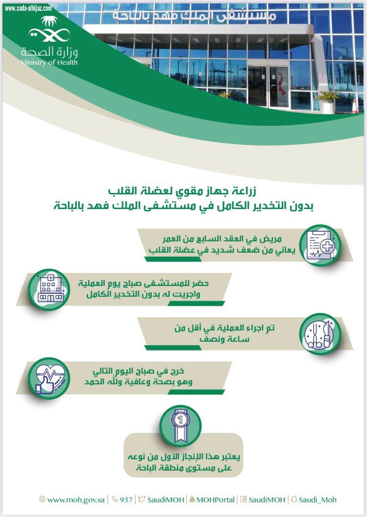 نجاح اول عملية زراعة جهاز مقوي لعضلة القلب بدون التخدير الكامل في مستشفى الملك فهد بالباحة