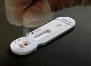 اختبار الأجسام المضادة لفيروس كورونا المغير لقواعد اللعبةيجتاز أولى التجارب بنتائج واعدة!