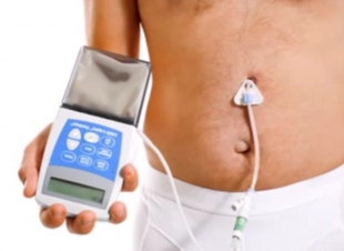 مستشفى الملك فهد بالمدينه المنوره يعيد لمريض ستيني النطق والحركه