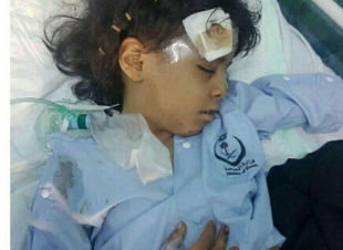 زينه جازان اصيبت بشظايا مقذوفه حوثي في الجمجمه ووالدها يناشد بعلاجها