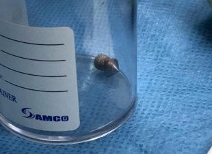 عملية قلب مفتوح عاجلة لشاب أصيب برصاصة بمستشفى الملك فهد بجدة